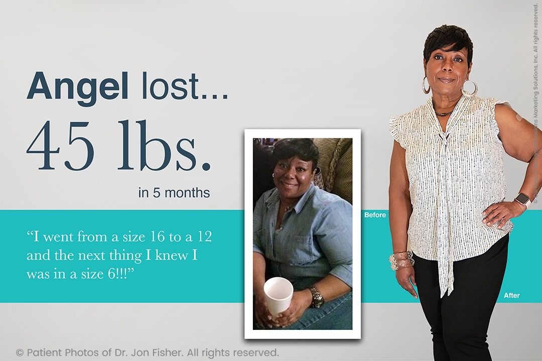 Dr. Polo's Medically Supervised Weight Loss Program - Before and After  Transformations